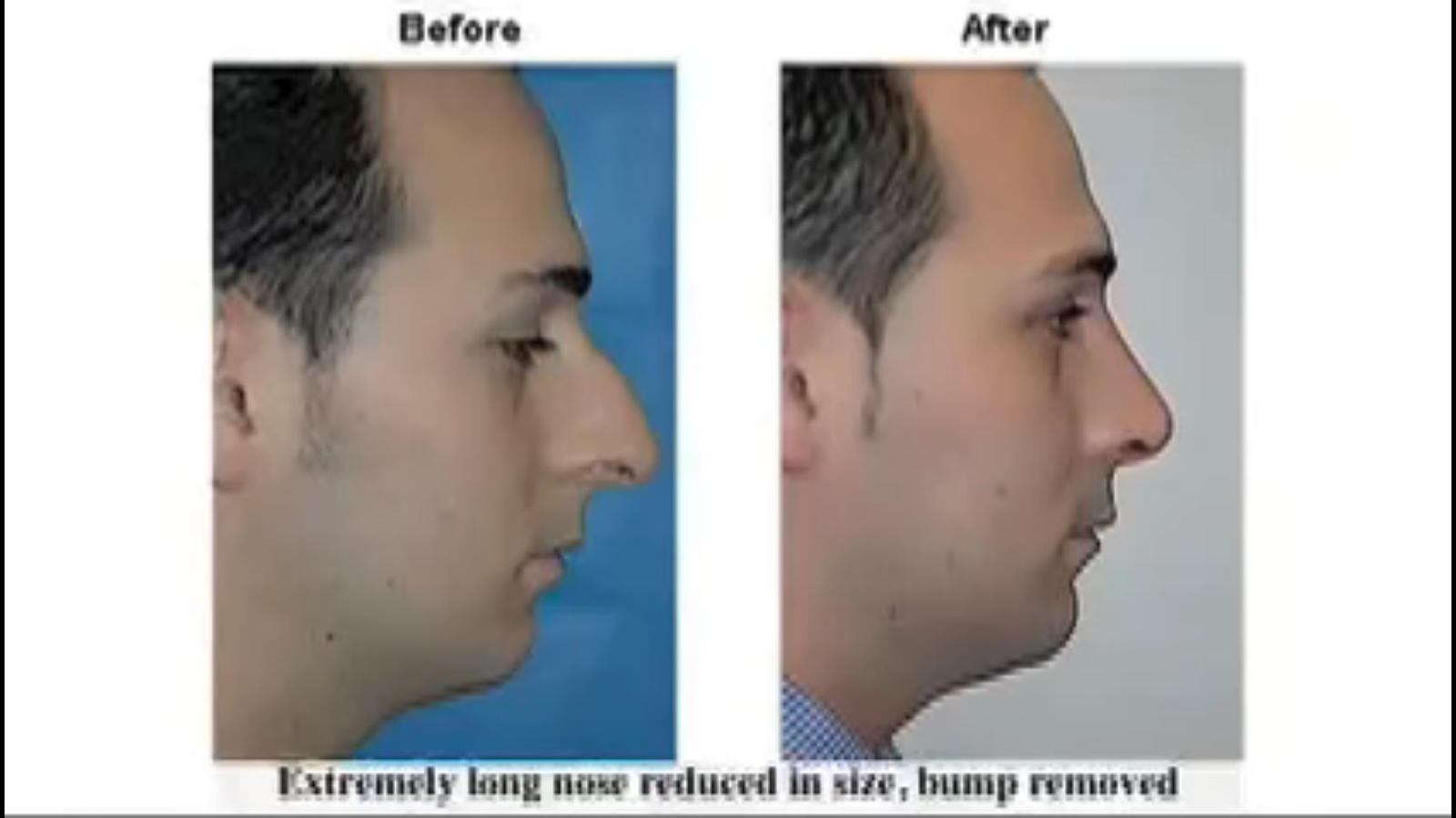 Allure Plastic Surgery