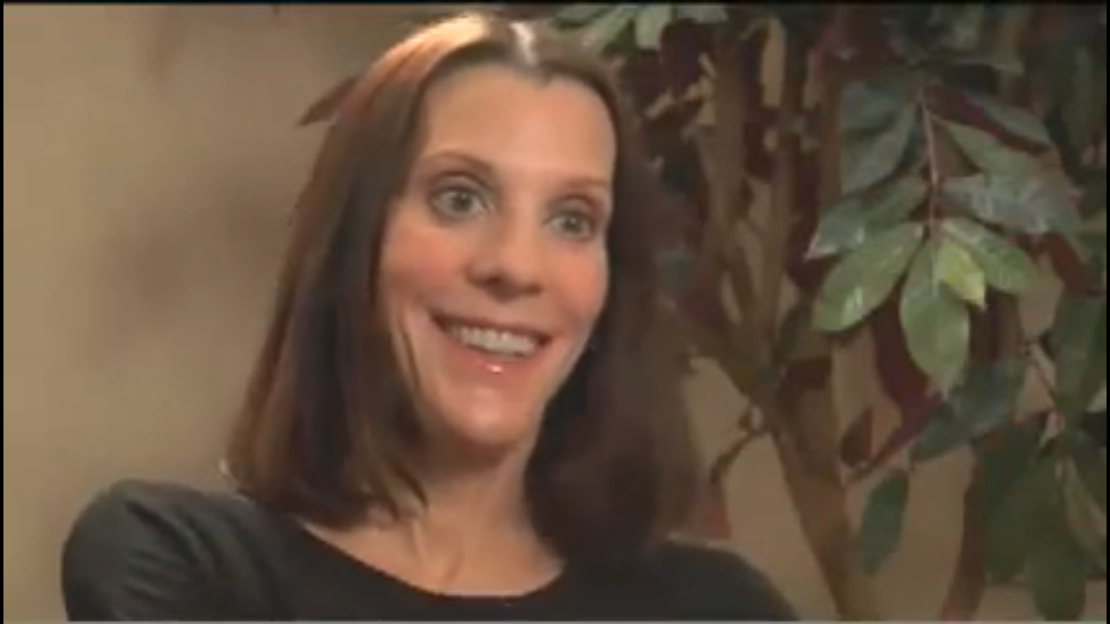 Christina habla sobre su experiencia con Botox y Juvederm